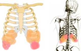 Болит 11 ребро при нажатии