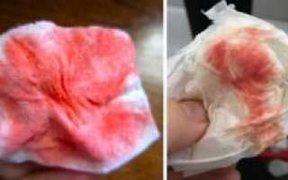 Имплантационное кровотечение и простуда