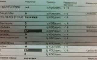 Какой мазок сдать при молочнице