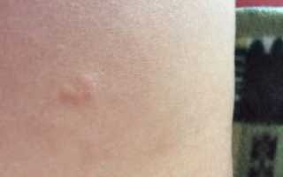 Маленький круглый чуть-чуть выпуклый бугорок