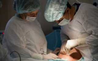 Кал с кровью после кесарево сечения