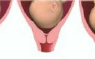 Короткая шейка матки в 17 недель помогите пожалуйста