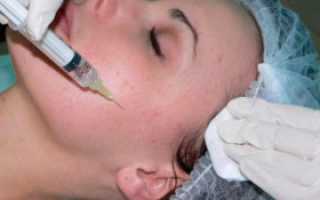 Кружится голова, горит лицо после дипроспана слидокаином сделали один укол