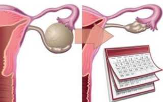 Киста яичника и рост волос на теле