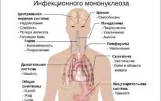 Кашель, температура 38,4-38,5, слабость, нет аппетита