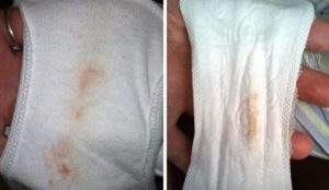 Имплантационное кровотечение и простуда