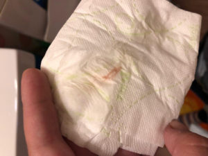 Имплантационное кровотечение и простуда