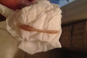 Кравинистые выделения во время приема Регулона