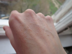 Красные пятна на коже (внешняя сторона ладони)