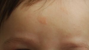 Маленький круглый чуть-чуть выпуклый бугорок