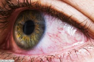 Красные сосуды