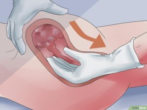 Кровь во влагалище