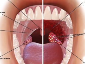 Боль в горле и под языком после сна