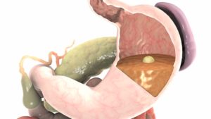 Переваренные кусочки еды во рту из желудка, очень вонючие