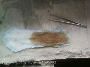 Мажет после мазков