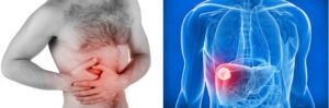 Боль в верхней части легких