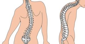 Хруст позвоночника у трехмесячного ребенка