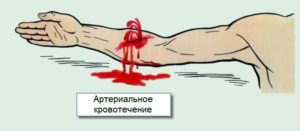 Кровь от натуживания, прием таваника