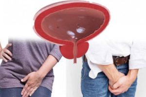 Боли внизу живота когда хочу в туалет