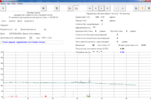 Ктг. Помогите разобраться с поправкой на сон