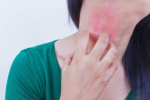 Красные пятна и боль