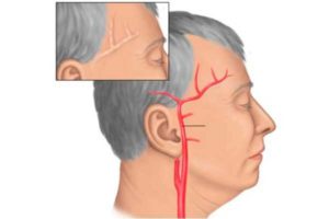 Болит голова, нестабильность в отделе С2