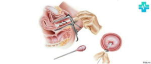 Мазок после секса