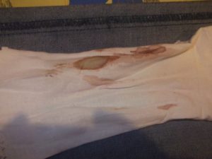 Кровные выделения через несколько дней после окончания месячных