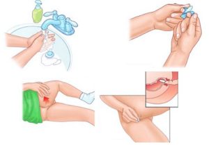 Использование грязной упавшей на пол свечи ректально