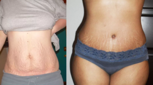 Изменения в теле после родов