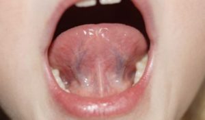 Боль в горле и под языком после сна