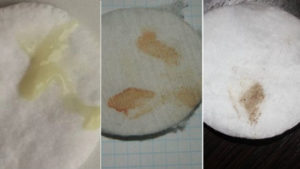 Коричневые выделения,  Возможно ли беременность?