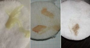 Коричневые выделения с кровью за 10 дней до месячных