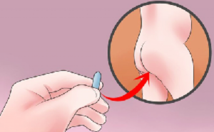 Использование грязной упавшей на пол свечи ректально