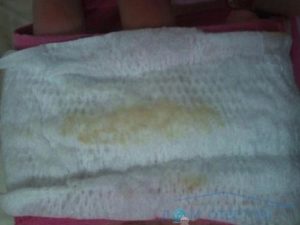 Кравинистые выделения во время приема Регулона