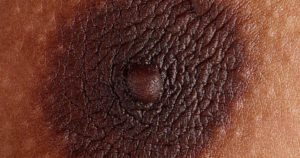 Коричневая корочка на сосках