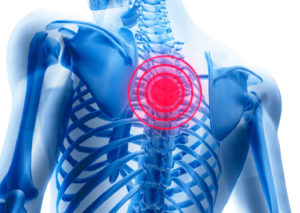 Болит позвонок между лопатками