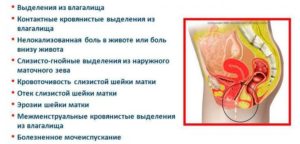 Боль внизу живота после секса