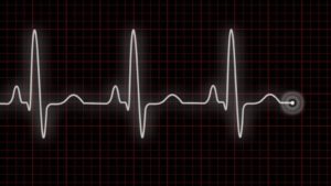 Быстро бьется сердце частый пульс