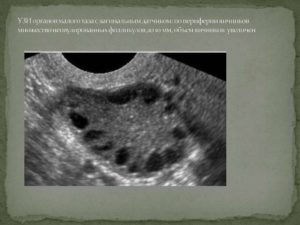 Мало или норма фолликул в яичниках