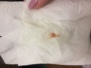 Кровотечение на 7 недели беременности