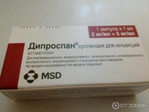 Как отказаться от дипроспана