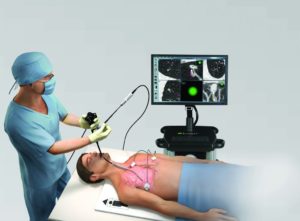 Бронхоскопия после КТ лёгких-необходимость?