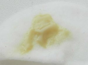 Мазок хороший, а выделения желтые обильные. Что это может означать?