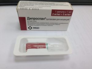 Как отказаться от дипроспана