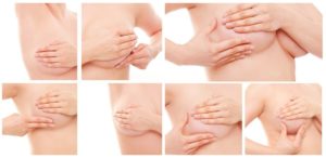 Лактостаз после перетягивания груди