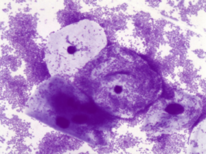 Мазок кокки и ключевые клетки