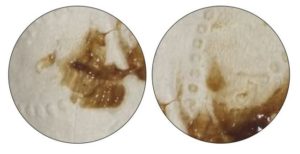 Мажет после мазков