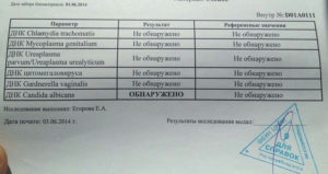 Какой мазок сдать при молочнице