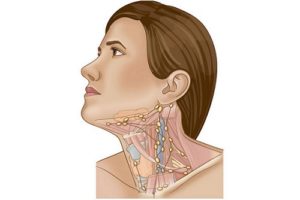 Боль в трахее увеличение лимфоузлов